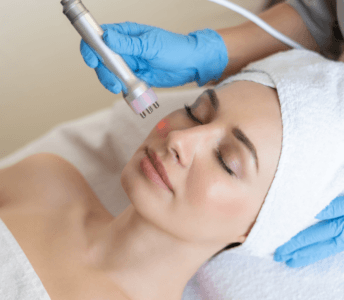 Ankara Altın İğne