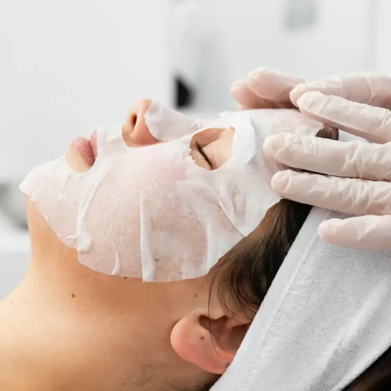 kimyasal peeling ankara